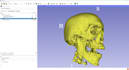 perform medical imaging segmentation and 3d visualization for ct mri
