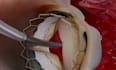 do 3d medical animation, 3d medical video, surgery animation, 3d anatomy