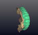 create accurate implant prosthesis designs using exocad