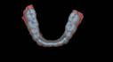 design a custom dental michigan night guard