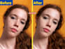 professional skin retouching, face retouch, blemish removal