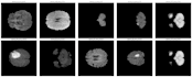 build medical imaging and computer vision models using deep learning