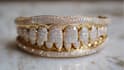 make custom and gem set cad grillz designs
