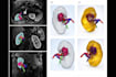 convert ct and mri scans into 3d printable medical models