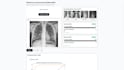 develop your custom ai tool for data analysis or chatbot
