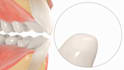 do 3d dental animation, 3d dentistry process, 3d medical animation