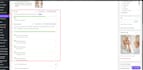 do on page search engine optimization by yoast SEO