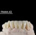 design dental digital projects exocad, 3shape, blender
