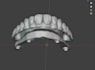 design dental crowns, bridges and implants using exocad