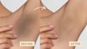 professionally retouch and edit skin
