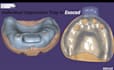 design individual digital dental tray