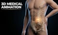 create ai 3d medical animation explainer video, medical device, 3d anatomy
