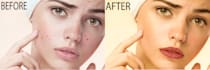 do photoshop skin retouching