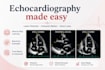 tutor echocardiography with real echo cases on zoom