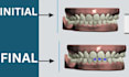 do dental clear aligner treatment planning on onyxceph and 3shape