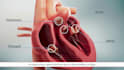 create 3d medical animation cardiovascular tavr heart aortic valve visualization