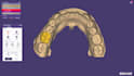 design crowns, bridges, using exocad