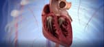 create 3d medical surgery procedure  human body anatomy animation