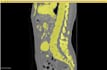 do ct and mri scans segmentation using 3d slicer