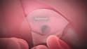 create realistic 3d surgical procedure animation surgical animation video
