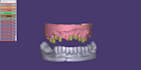 design dental prothesis all on using exocad
