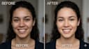 do professional skin retouching and remove acne naturally