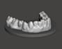 clean and optimize dental scans for 3d printing