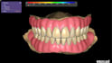 deisgn dental removable dentures