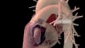 do 3d medical animation 3d surgical device animation 3d anatomy explainer video