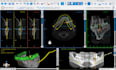 do professional implant planning and surgical guides