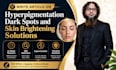 write SEO article on hyperpigmentation, winter skin care problems