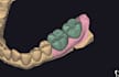 provide professional exocad dental design and 3d modeling services