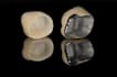 do dental prosthesis crown design using exocad, 3shape, inlab and cerec