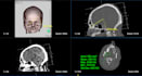 medical imaging viewer development ohif cornerstone expert
