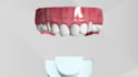 create 3d dental medical animation, 3d clear aligner simulation animation video