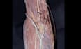 teach you anatomy spotters using real cadaveric image