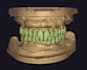 reliable dental cad cam outsourcing service