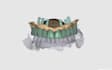 do expert dental designs on exocad