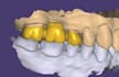 design professional dental crowns, bridges