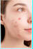 do skin retouching photo editing