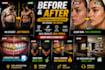 create professional before and after social media designs
