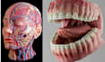 create 3d medical animation, surgery animation, medical explainer video