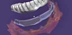 install exocad and 3shape dental software remotely