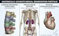 do medical image segmentation and 3d modeling using 3d slicer