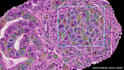build a CV model for image segmentation using pytorch