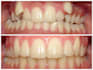 create expert clear aligner treatment plans for orthodontists