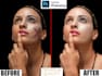 remove blemishes, pimples and enhance your portrait professionally