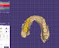 design professional dental cad crwonbridge using exocad