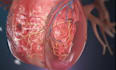 create a professional 3d medical animation video