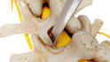 create 3d medical device animation and surgical procedures